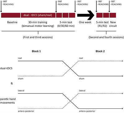 Bimanual motor skill learning after stroke: Combining robotics and anodal tDCS over the undamaged hemisphere: An exploratory study